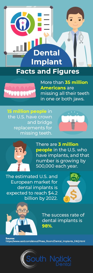 Dental Implant Facts & Figures - Infographic Natick, MA