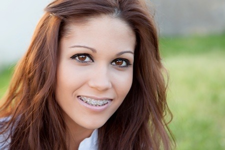 Invisalign® vs. Traditional Braces Natick, MA